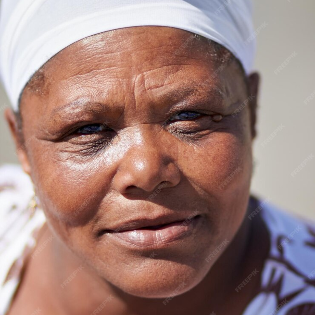 Wrinkles and Fine Lines